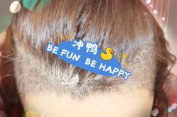 -大麦微针植发全国连锁