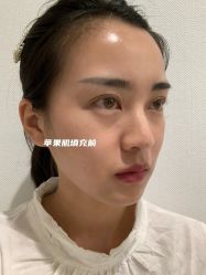 -Yestar宁波艺星整形医院