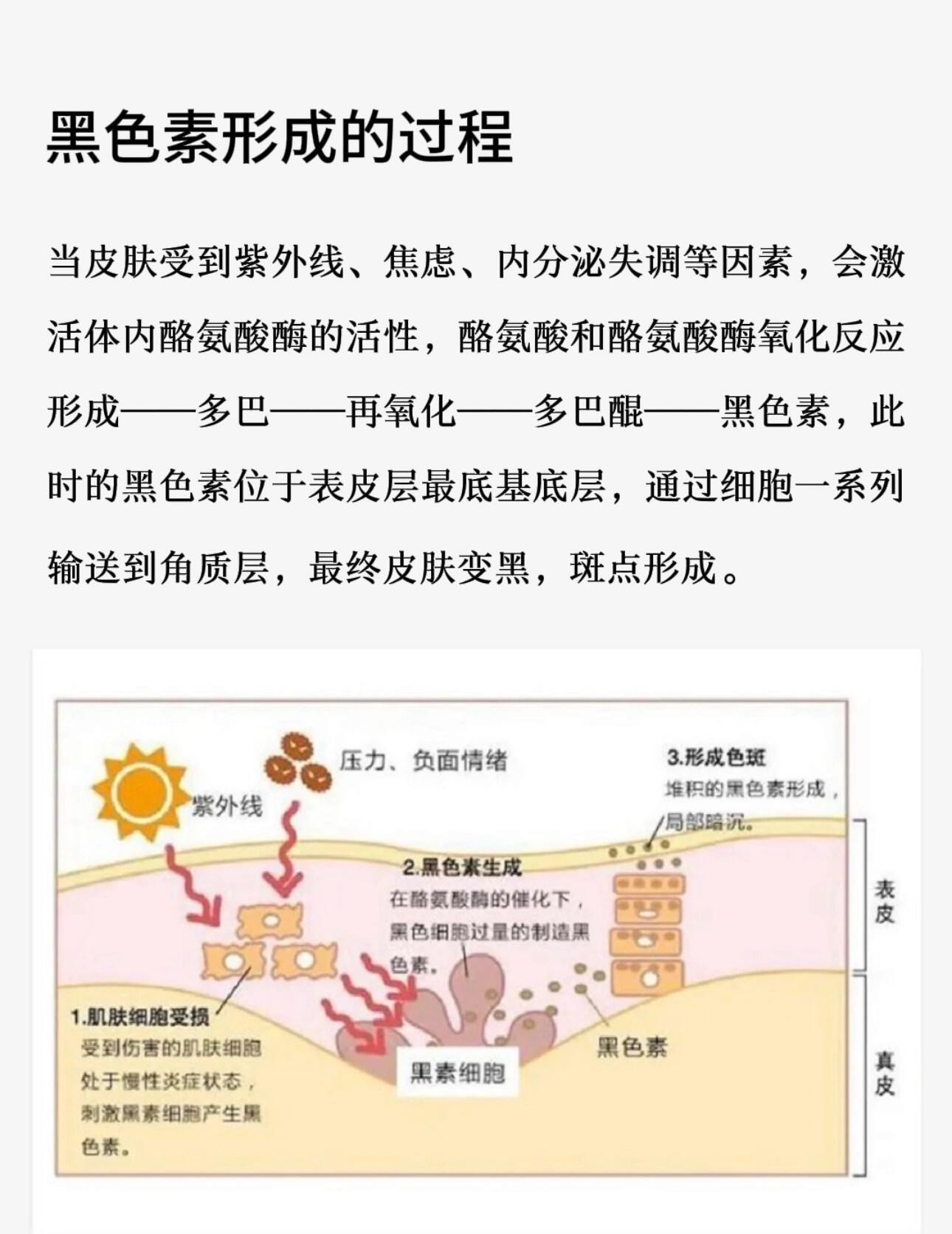 长斑的原因图解图片