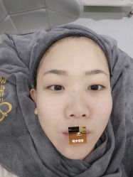 体验后-天河爱来医疗美容门诊部