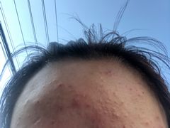 -上海市皮肤病医院(武夷路院区)