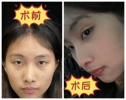 -素美医疗美容·西南眼鼻整形·修复基地