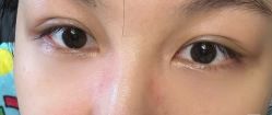 -广州美莱医疗美容医院