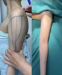 -郡艺医疗美容·微整·眼鼻吸脂