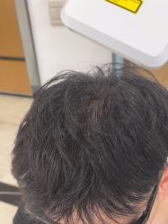 -雍禾植发
