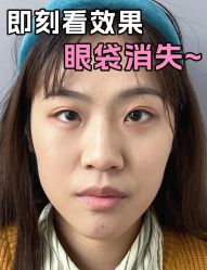 -广州健丽·去眼袋医疗美容机构