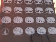 -哈尔滨医科大学附属第四医院(南岗院区)