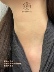 -清疣美疣·痣·斑净肤中心