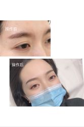 -久匠半永久纹眉