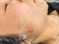 -长沙雅美医疗美容医院