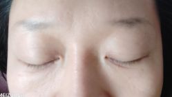 -郡艺医疗美容·微整·眼鼻吸脂