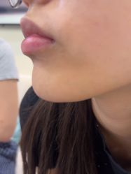 -长沙雅美医疗美容医院