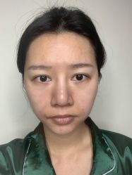 -成都西区医院整形美容
