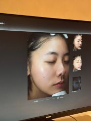 -爱小熊轻医美