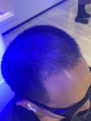 -雍禾植发全国连锁