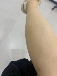体验后-医方嘉明医疗美容