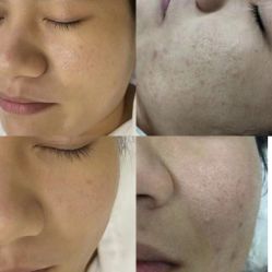 -Cream88颜皮肤管理中心