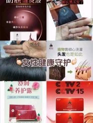 -顶尚堂白发脱发养发