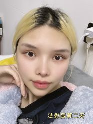 -上海玫瑰医疗美容医院