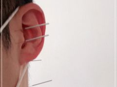 -中国中医科学院西苑医院(本部)