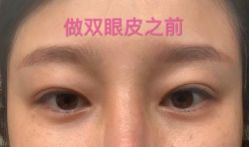 点击看大图 -苏州卫康美容医院