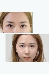 -Doris多里斯半永久纹眉·SMP纹发·发际线