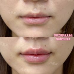 -深圳艺星医疗美容医院