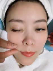 -北京丽星翼美医疗美容