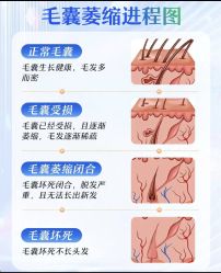 -Bollins波林丝•专研护发中心