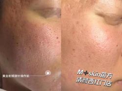 -苗方清颜痘肌研究所