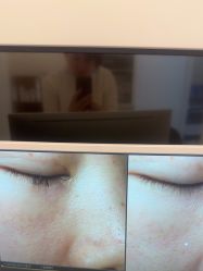 -苑苑vbeauty科技美容SPA