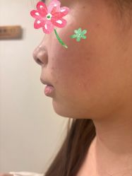 -长沙雅美医疗美容医院