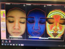 皮肤检测 -光SPA科技美肤