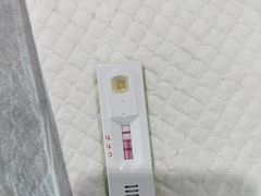 细小和冠状双红-思琪宠物医院(昆山花桥店)