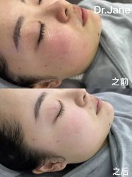 体验前-Dr.Jane皮肤管理中心