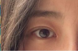 -紫洁俪方（北京）医疗美容