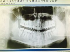 -爱贝口腔·牙周诊疗·种植修复中心