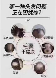 -希梵尔头皮抗衰·科技养发