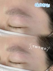 点击看大图 -张小野·专业半永久纹眉
