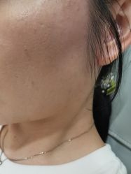 -美瑞莎创美医疗美容