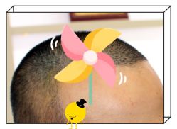 -大麦微针植发全国连锁