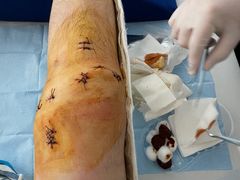 -浙江省中医院(湖滨院区)