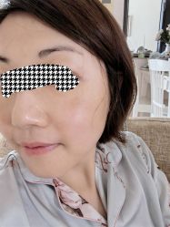 体验后-广州美莱医疗美容医院