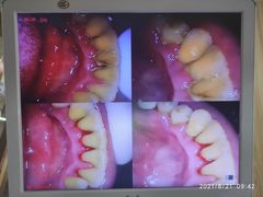 -爱牙联合口腔(门诊报销 海云庵店)