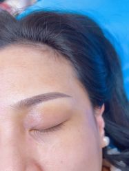 体验后-郡艺医疗美容·微整·眼鼻吸脂