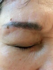 体验后-深圳美莱医疗美容医院