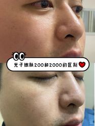 -八大处整形
