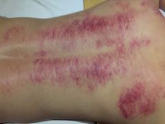 -鸿喜足健康足道采耳艾灸(南纬路店)