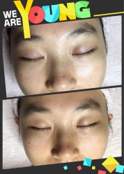 前后效果对比图-源素美容养生会所