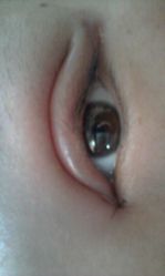 -安徽合肥韩美整形外科医院